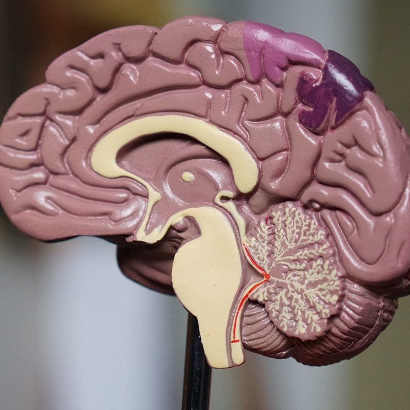 brain mold cut in half brain mold cut in half